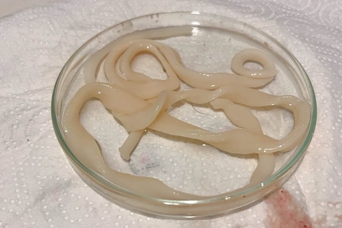  Ligula intestinalis,   